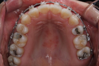 부산연산동교정치과