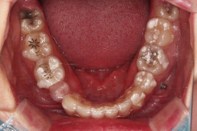 부산인비절라인