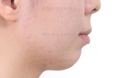 부산무턱교정치과