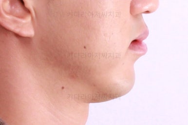연산동교정전문치과