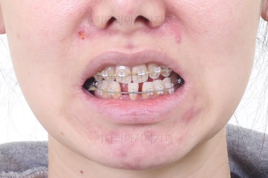 부산재교정치과