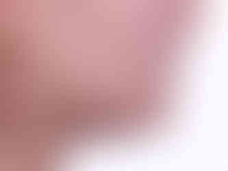 연산동치아교정