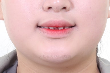 부산교정치과추천