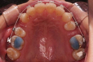 연산동교정치과