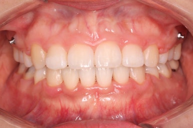 부산연산동교정치과