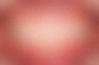 부산연산동교정치과