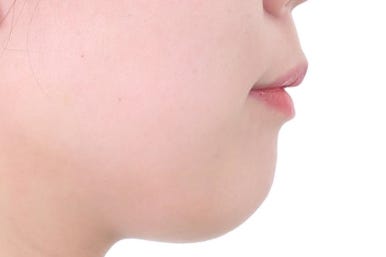 부산연산동교정치과