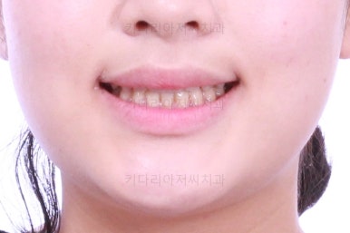 부산교정치과추천