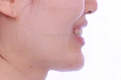 부산교정치과