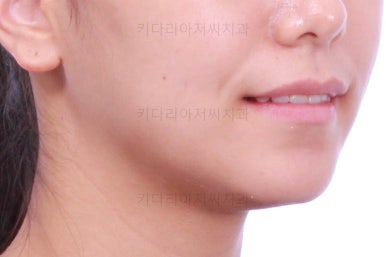 부산교정잘하는치과