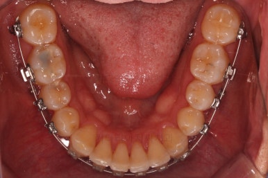 부산교정치과추천