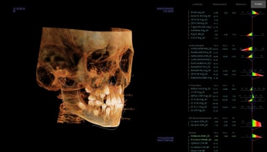 부산어린이교정