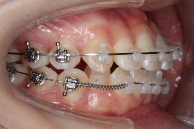 연산동교정치과