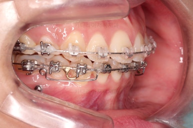 연산동치아교정치과