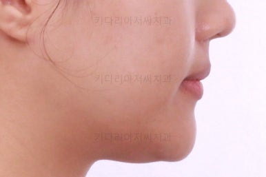 연산동치아교정치과