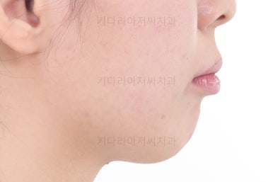 부산무턱교정치과