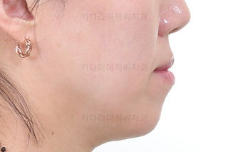 부산교정치료