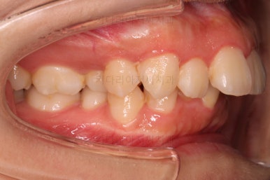 부산무턱교정치과