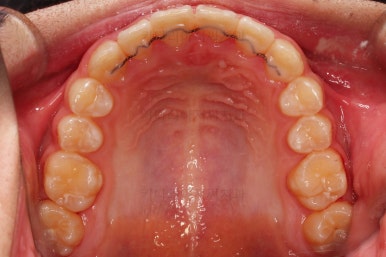 부산청소년교정