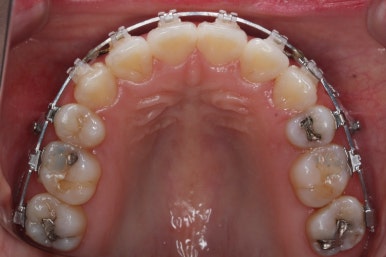 부산연산동교정치과