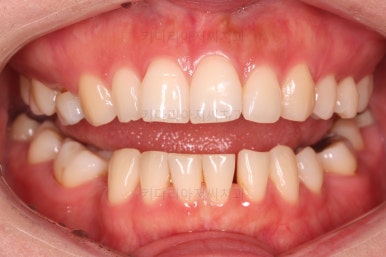 부산인비절라인