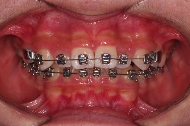 부산청소년교정