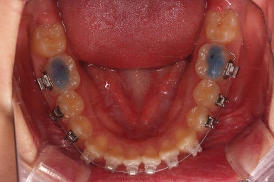 부산교정전문의