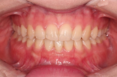 부산교정치과추천