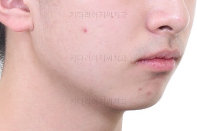 부산교정치과추천