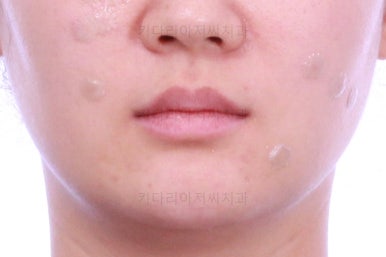 부산인비절라인