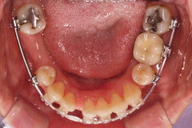 부산재교정치과