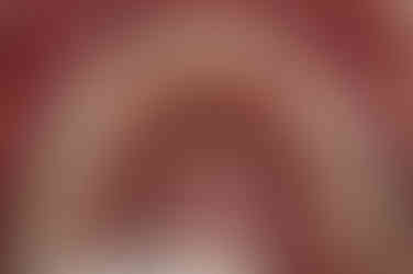 부산왜소치교정