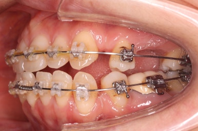 부산재교정치과