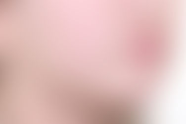 부산덧니교정