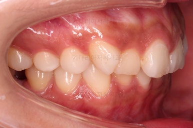 연산동교정치과