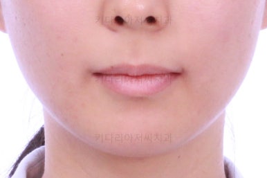 부산무턱교정치과