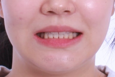 부산교정전문의