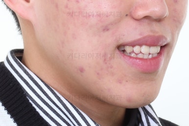 부산교정과전문의