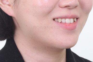 부산치아교정잘하는곳