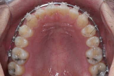 부산치아교정치과