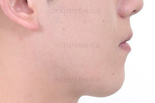 부산치아교정