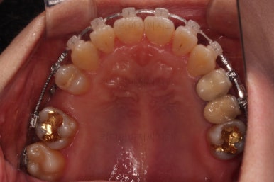 부산연산동치과