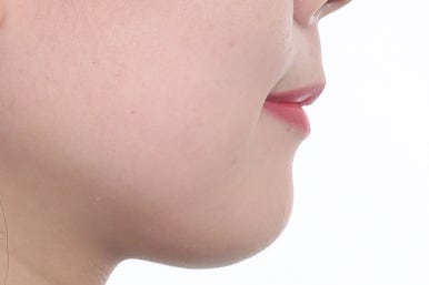 부산연산동교정치과