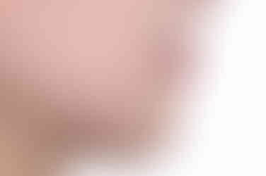 부산연산동교정치과