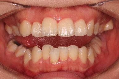 부산무턱교정치과