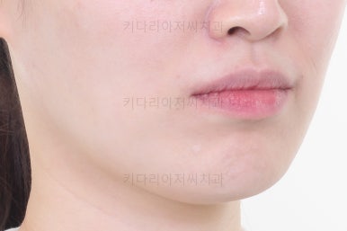 부산교정치과
