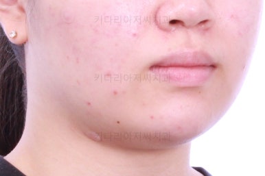 부산치아교정치과