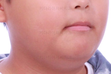 부산어린이교정