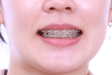 부산교정