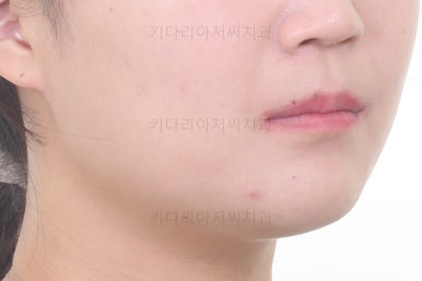 부산치아교정치과